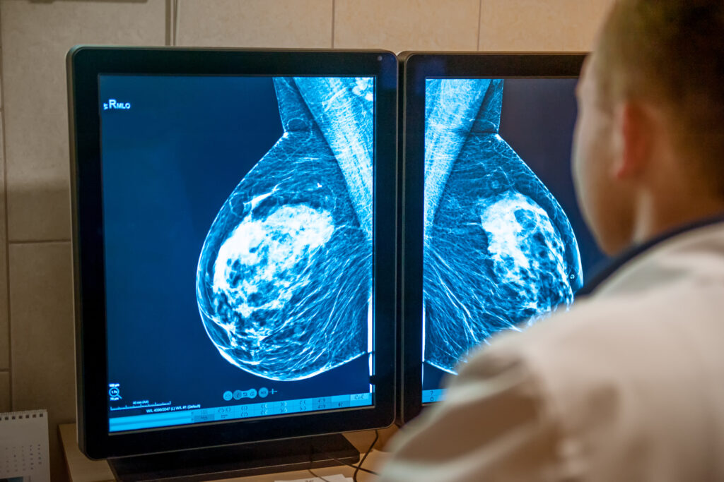 breast scan